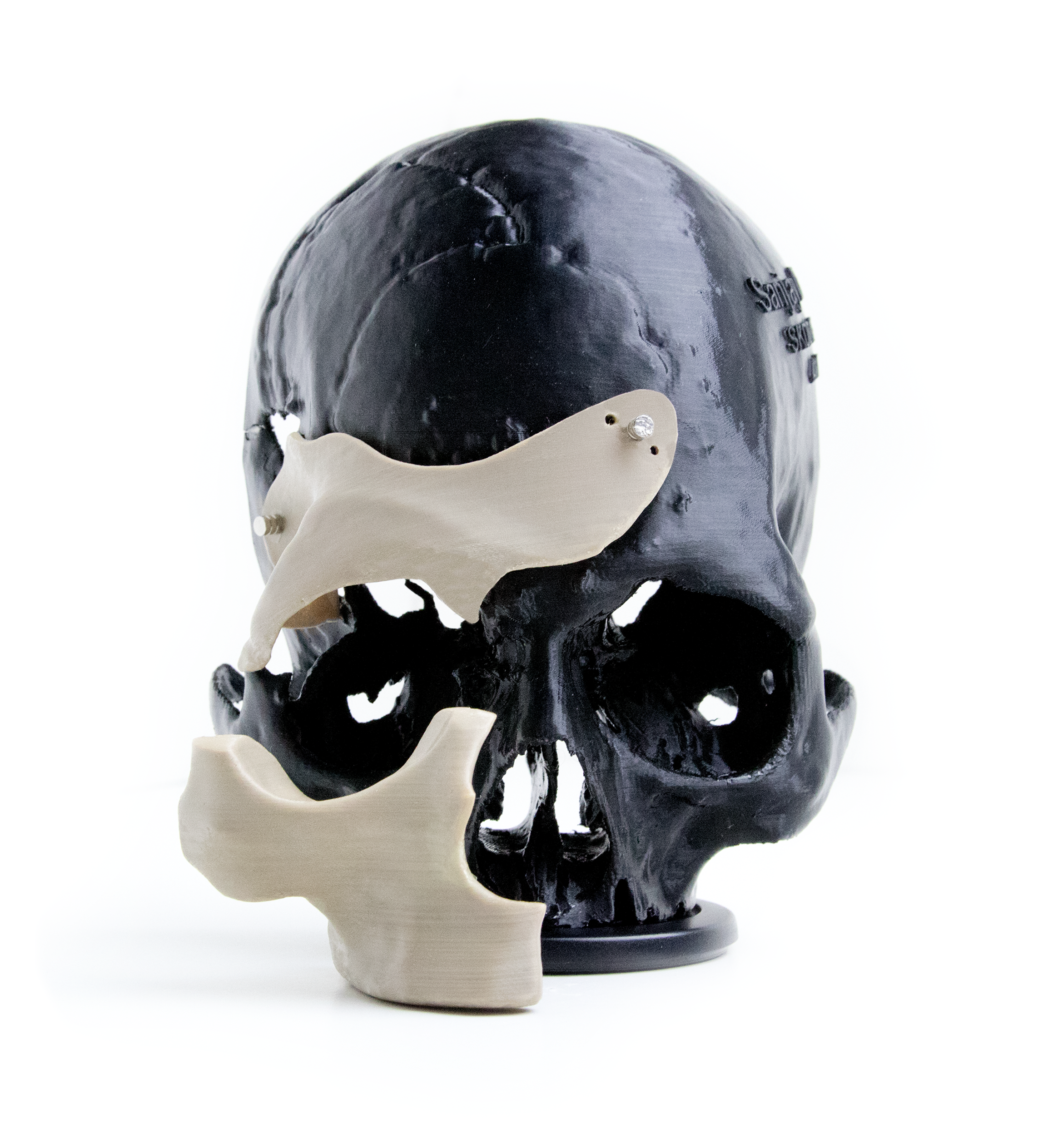 Apium_Medical_PEEK_3D_Printing_PEEK 1